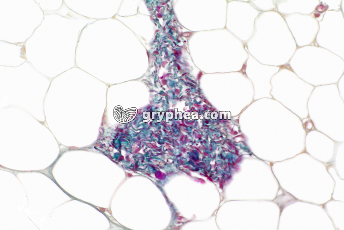 Tissu adipeux dégraissé x100 - gryphea.com